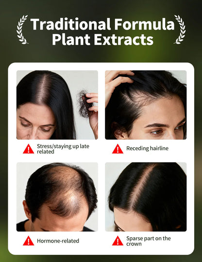 Anti-Hair Loss Serum Set