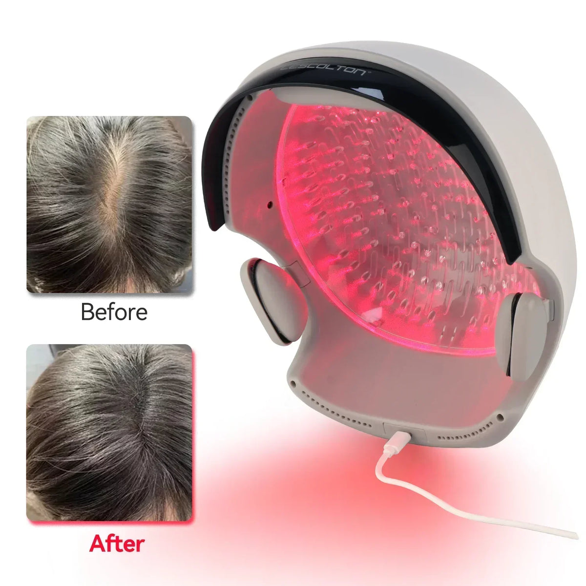 LLLT Hair Regrowth Helmet