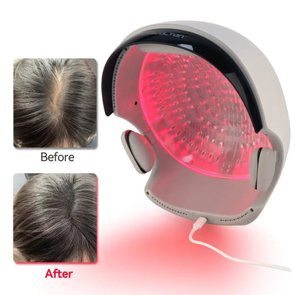 LLLT Hair Regrowth Helmet