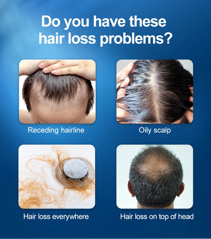 LLLT Hair Regrowth Helmet