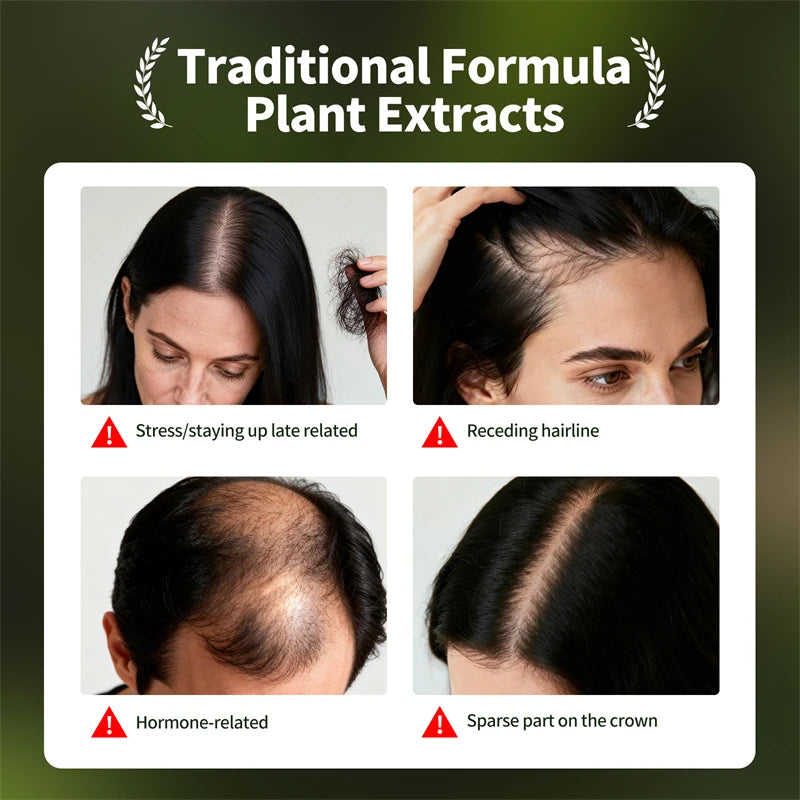 Anti-Hair Loss Serum Set