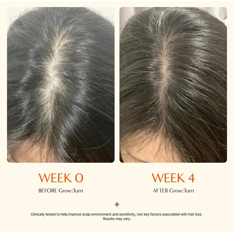 Korean Hair Serum with Scalp Brush