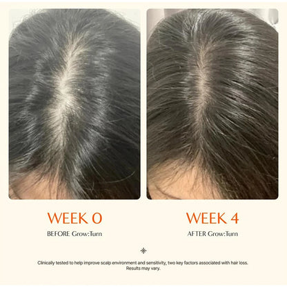 Korean Hair Serum with Scalp Brush