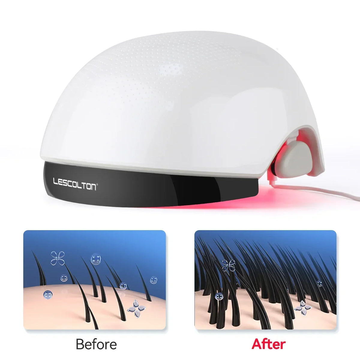 LLLT Hair Regrowth Helmet