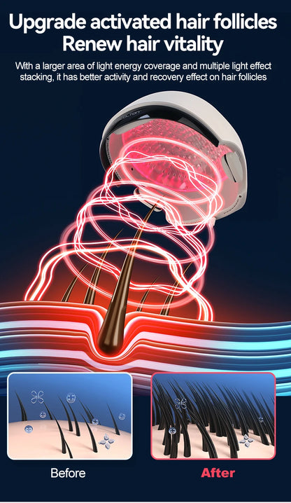LLLT Hair Regrowth Helmet