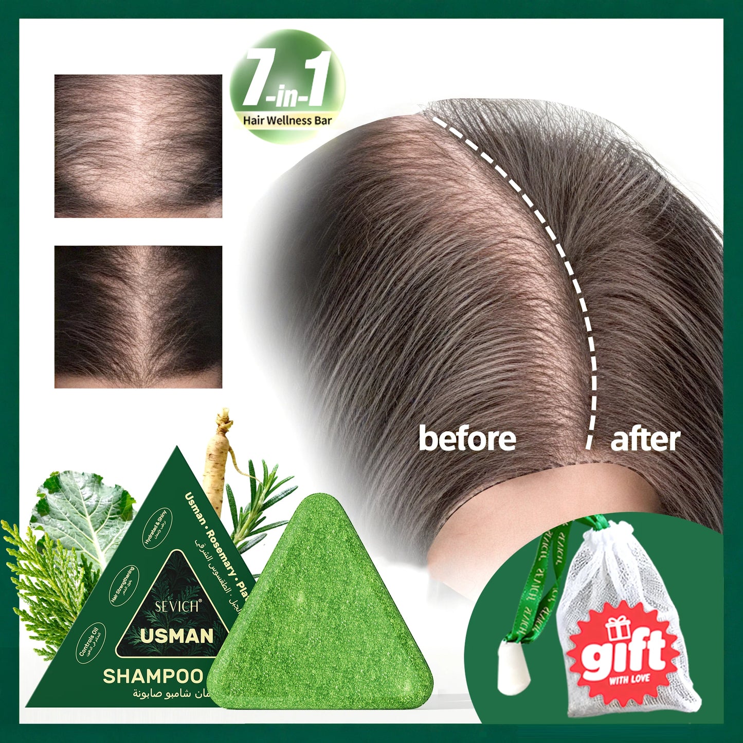Anti-Hair Loss Serum Set