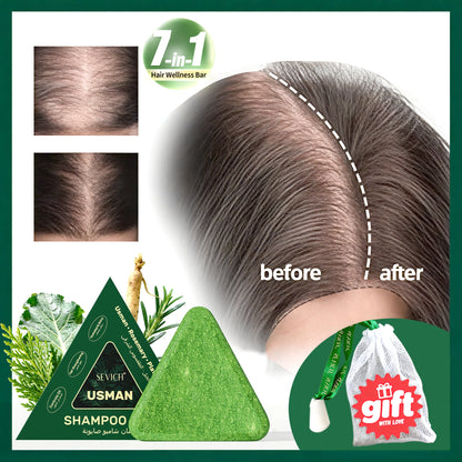 Anti-Hair Loss Serum Set